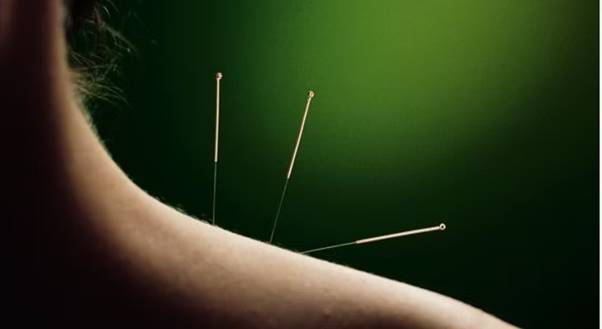 Aromatherapy essential oils and acupuncture needles for holistic wellness.